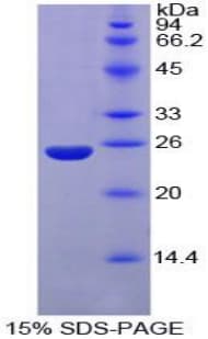 Mouse NUP160 Protein (Recombinant His-T7)