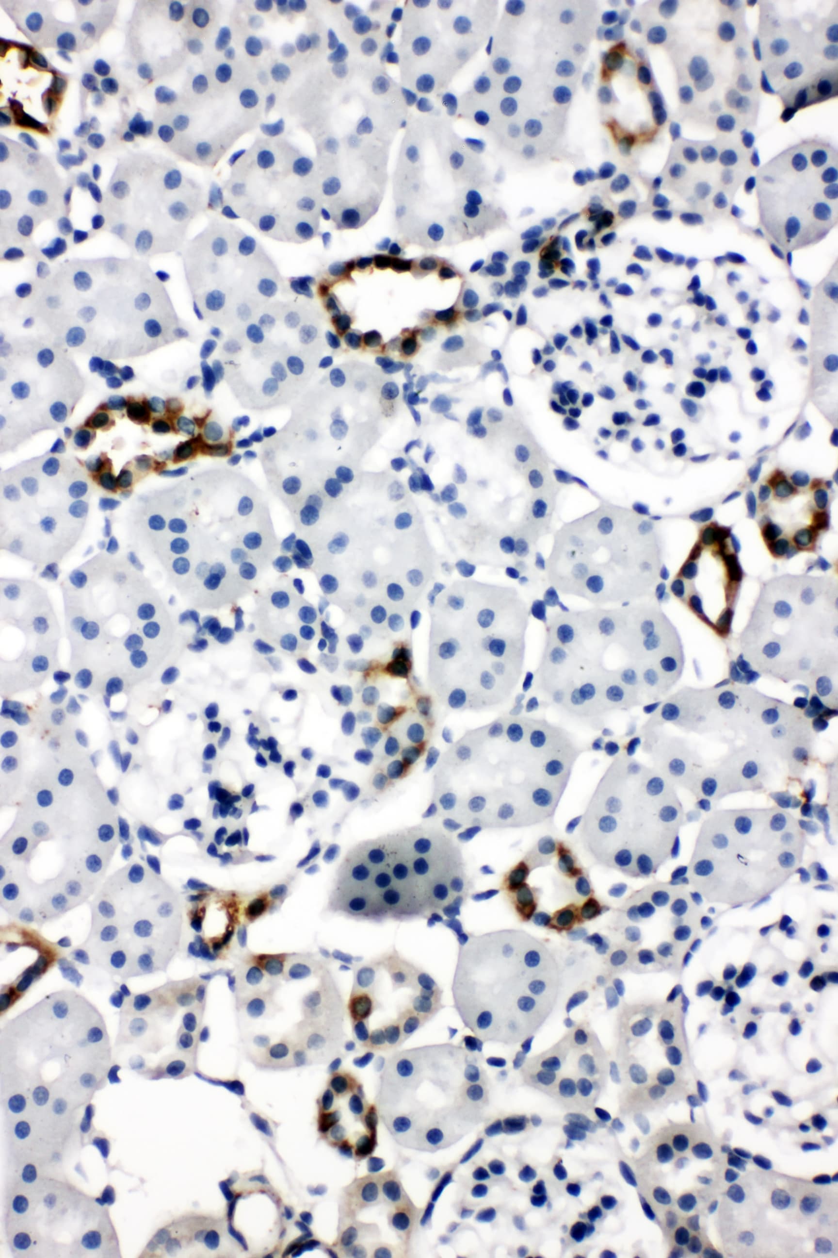AQP2 / Aquaporin 2 Antibody (aa245-260)