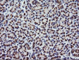 CD45 / LCA Antibody (clone OTI2H1)