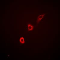 Polyclonal Rabbit anti-Human ITPKA Antibody (IF, WB)