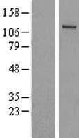 Human UBE1L2 / UBE1L2 Protein (Over-Expression Lysate Myc-DDK (Flag))