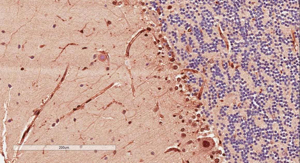 DCX / Doublecortin Antibody (aa232-242)