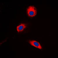 MAP2K3 / MEK3 / MKK3 Antibody (phospho-Thr222)