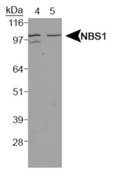 NBN / Nibrin Antibody (Internal)