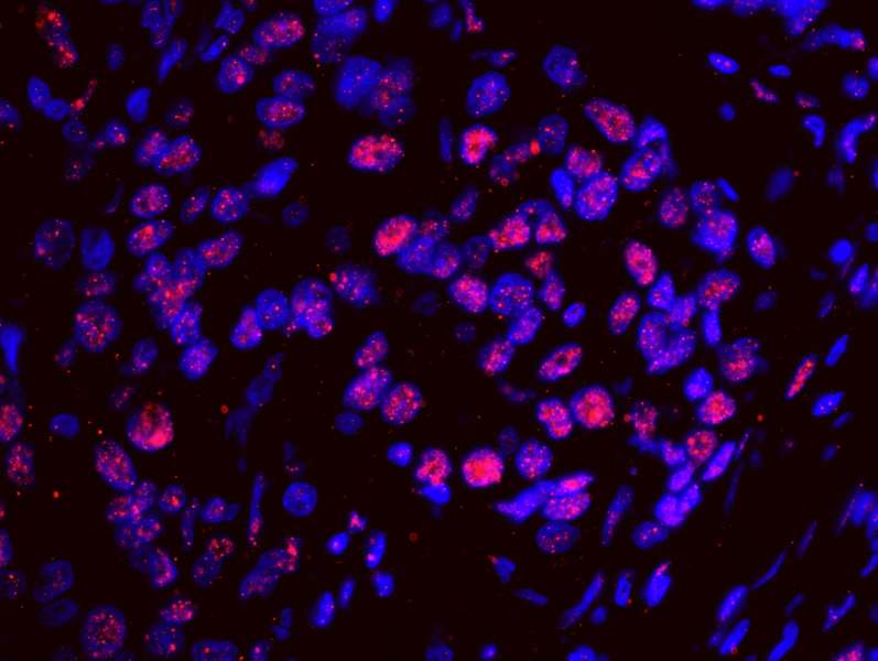Polyclonal Rabbit anti-Human SF3A1 / SF3A120 Antibody (aa300-350, IHC, IF)