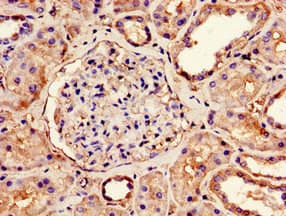 NDUFS4 Antibody