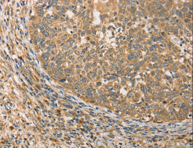 ATG3 Antibody