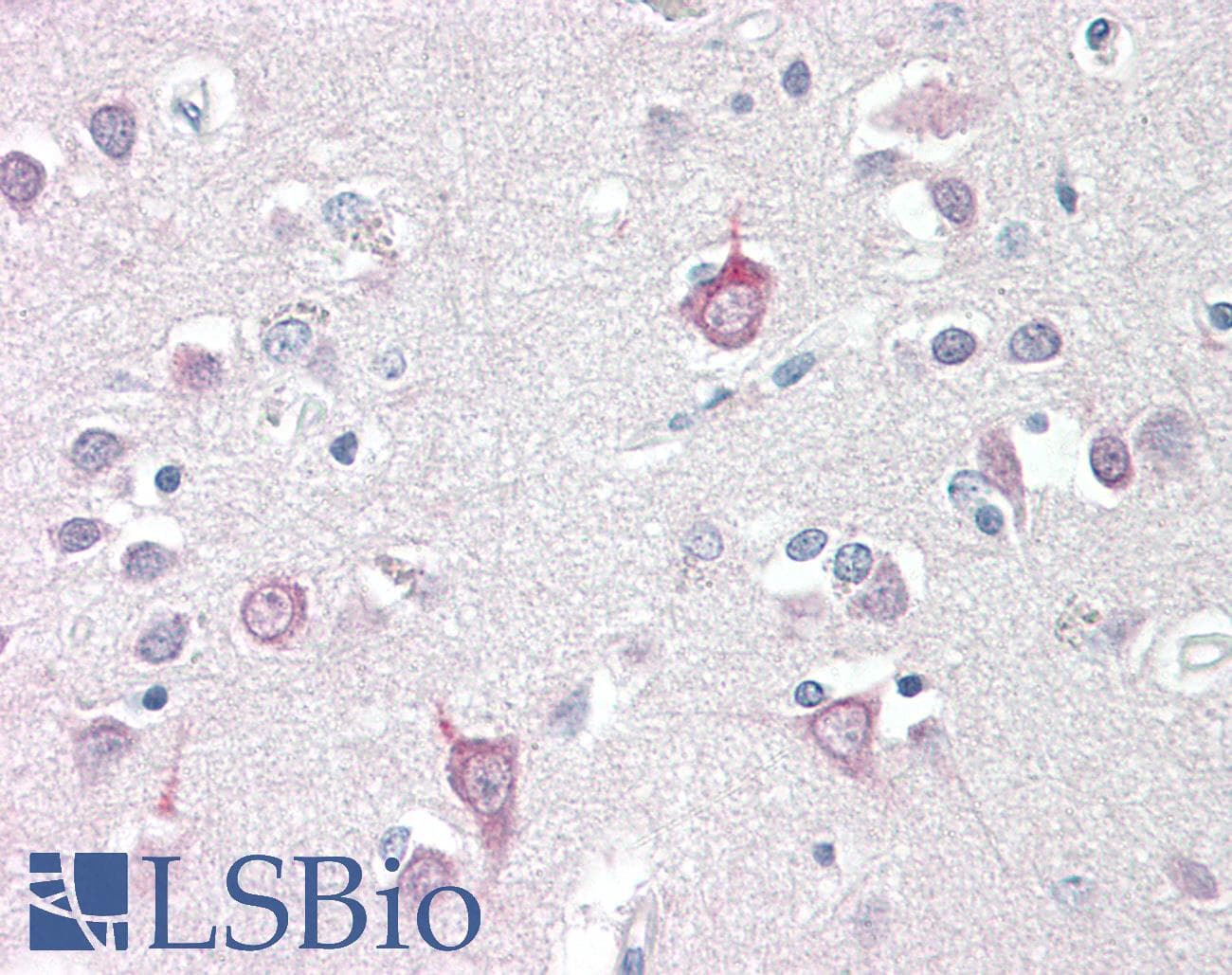 IHC-plus™ AP3B2 Antibody