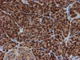SAT2 Antibody (clone OTI1C9)