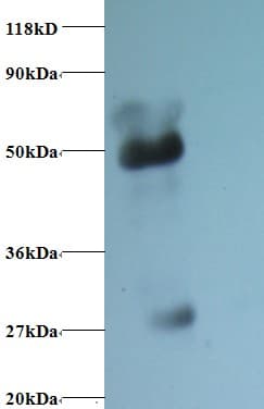 ORM1 / Orosomucoid Antibody