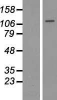 HDAC9 Protein (Over-Expression Lysate Myc-DDK (Flag))