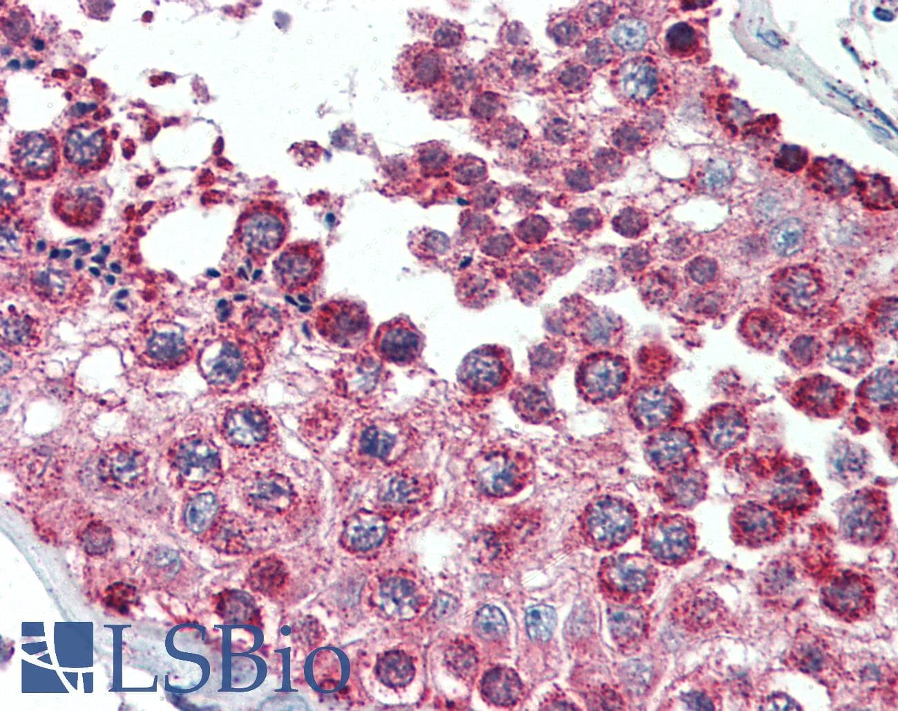 PathPlus™ SOD2 / Mn SOD Antibody