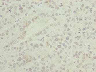Polyclonal Rabbit anti-Human ASNSD1 Antibody (IHC)