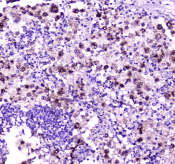 NPC2 Antibody