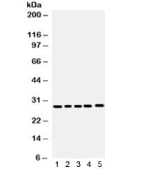 Polyclonal Rabbit anti-Human APH1A / APH-1 Antibody (WB)
