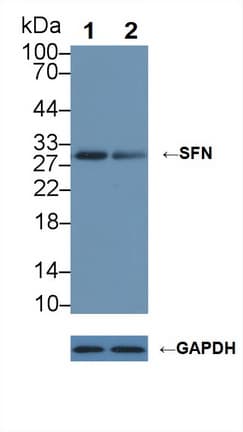 SFN / Stratifin / 14-3-3 Sigma Antibody (aa1-248)