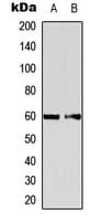 Polyclonal Rabbit anti-Human EIF2B4 Antibody (Internal, WB)