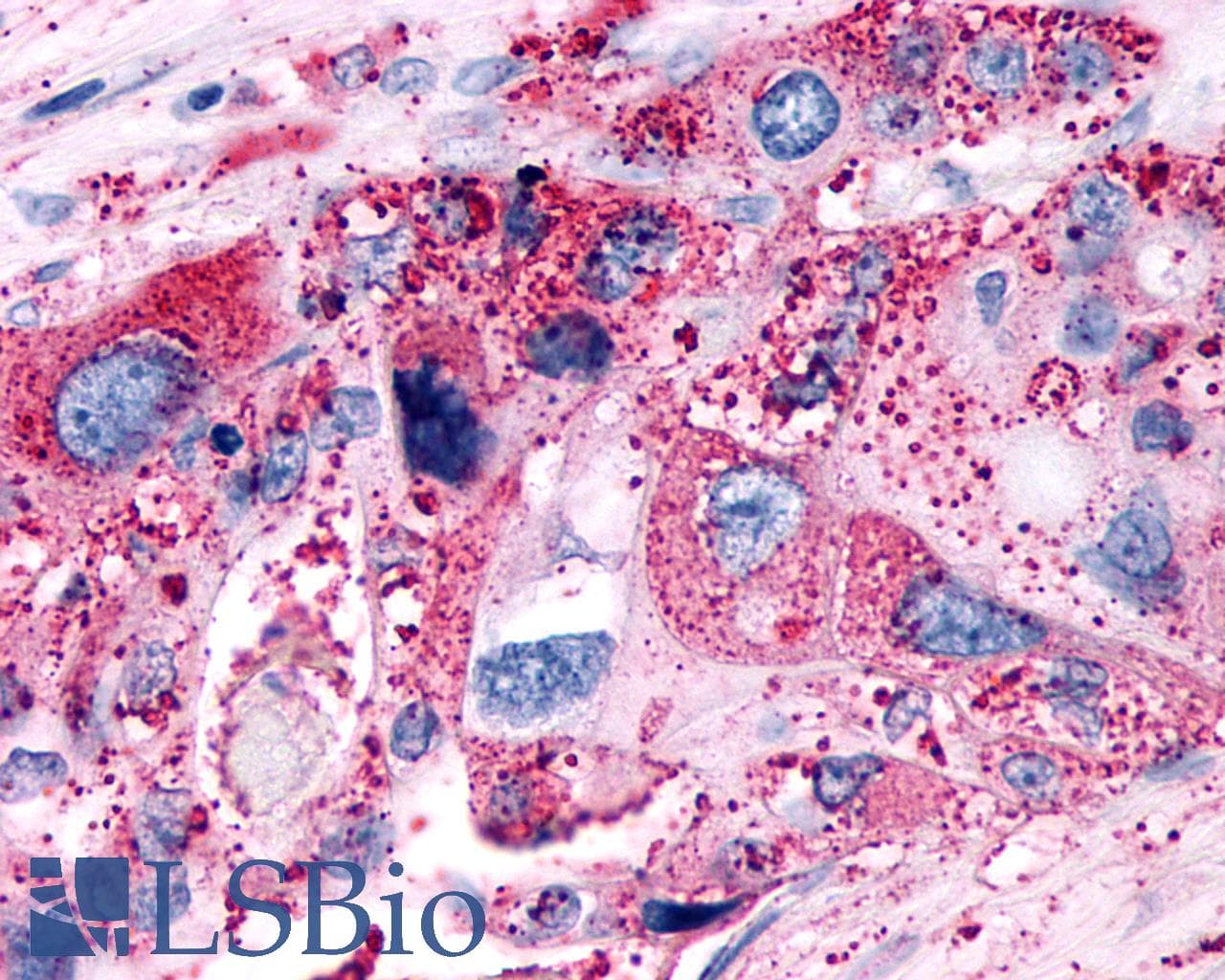 PathPlus™ Polyclonal Rabbit anti-Human P2RY6 / P2Y6 Antibody (Cytoplasmic Domain, IHC)