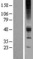 ZACN Protein (Over-Expression Lysate Myc-DDK (Flag))