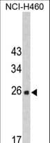 Polyclonal Rabbit anti-Human FKBP14 Antibody (aa37-68, IHC, WB)