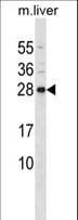 CD79B / CD79 Beta Antibody (aa93-121)
