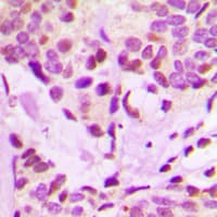IRX3 Antibody (Internal)
