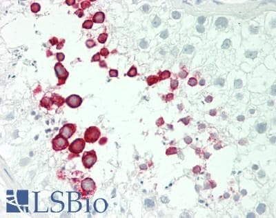 IHC-plus™ Polyclonal Rabbit anti-Human IFNA4 / Interferon Alpha 4 Antibody (aa162-189, IHC, WB)