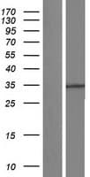 HT036 / HYI Protein (Over-Expression Lysate Myc-DDK (Flag))