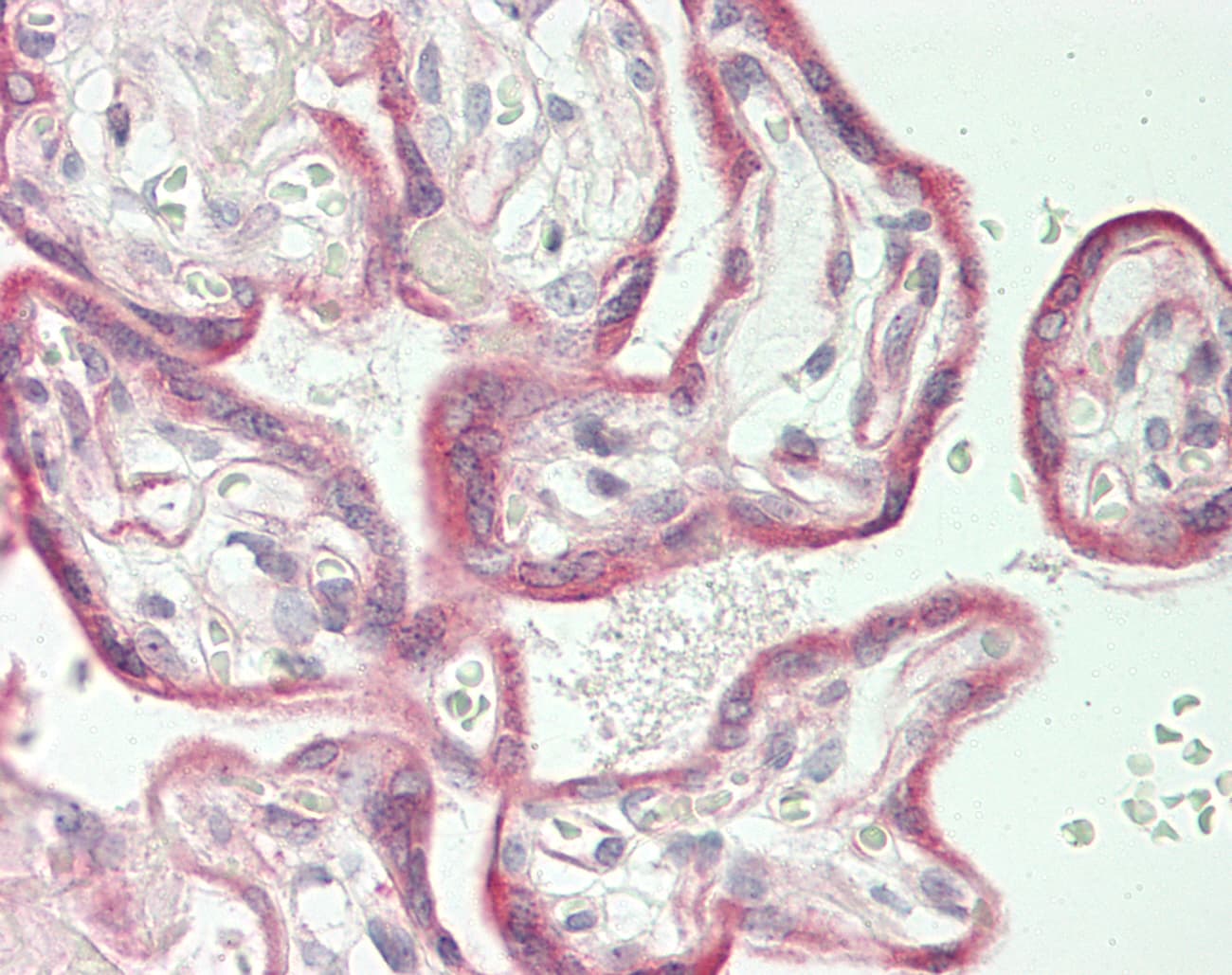 IHC-plus™ SCN9A / Nav1.7 Antibody (aa702-747)