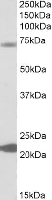 IHC-plus™ KCNN2 Antibody (aa545-557)