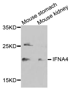 Polyclonal Rabbit anti-Human IFNA4 / Interferon Alpha 4 Antibody (WB)