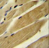 RPH3AL Antibody (aa208-237)