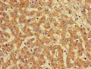 CUTA Antibody