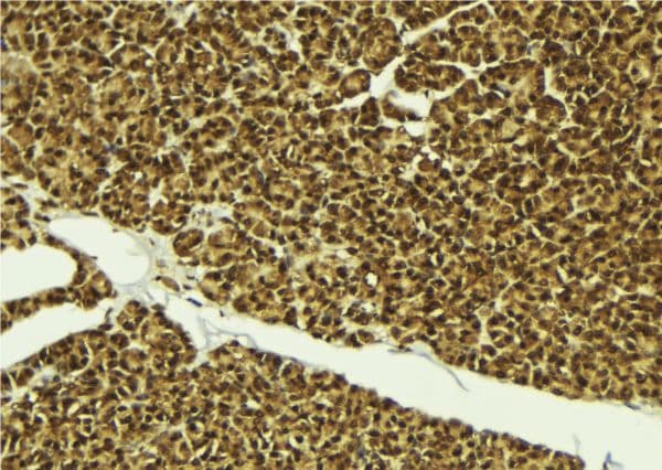 CMTM8 Antibody