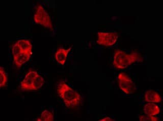 Polyclonal Rabbit anti-Human OR5H1 Antibody (IF, WB)
