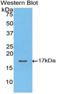 HIF1A / HIF1 Alpha Antibody (aa45-180)