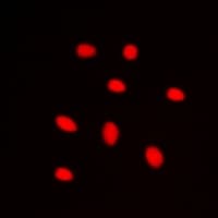 Polyclonal Rabbit anti-Human ZNF668 Antibody (Internal, IHC, IF, WB)