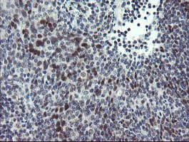 ZBED1 / TRAMP Antibody (clone OTI5A2)