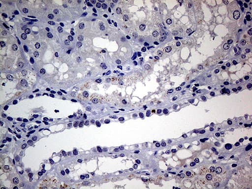 AR / Androgen Receptor Antibody (aa420-659, clone OTI2E11, Carrier-free)