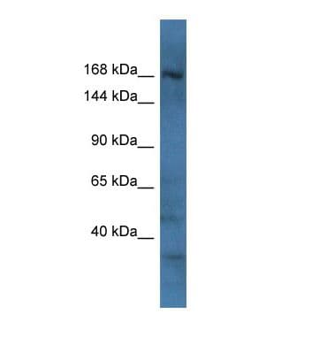 Polyclonal Rabbit anti-Mouse RAPGEF2 Antibody (FITC, aa1274-1323, IHC, WB)