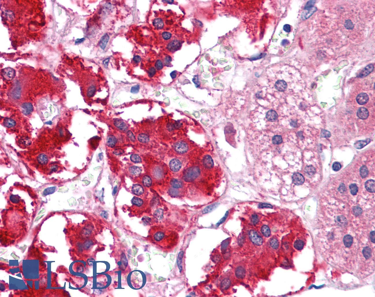 IHC-plus™ Monoclonal Mouse anti-Human EPHB3 / EPH Receptor B3 Antibody (clone 4A122D1, IHC, WB)