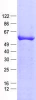 Human NET1 / ARHGEF8 Protein (Recombinant His, N-Terminal)