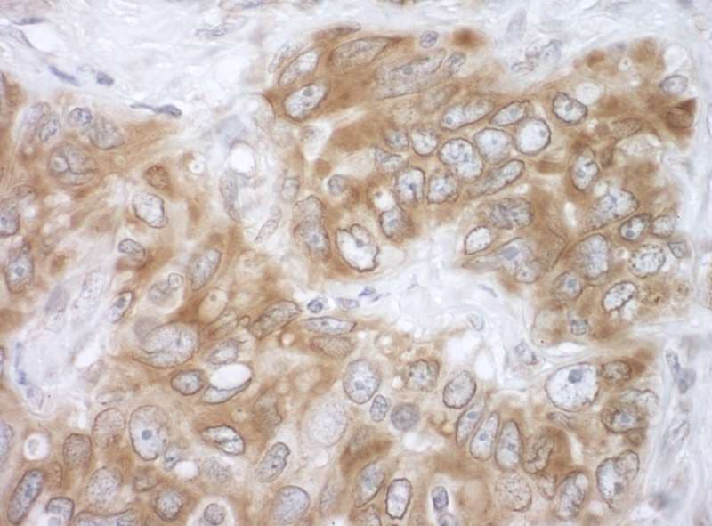 Polyclonal Rabbit anti-Human VAPB Antibody (aa100-150, IHC, WB)