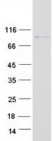 Human RAP1GAP Protein (Recombinant Myc-DDK (Flag))