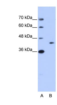 GIPC1 / GIPC Antibody (aa40-89)