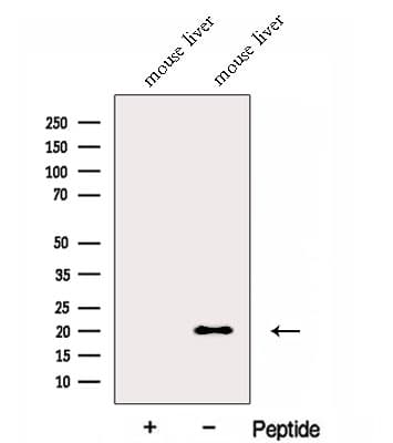 FNDC5 / Irisin Antibody