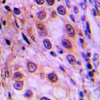 MRPL41 / PIG3 / BMRP Antibody (Internal)