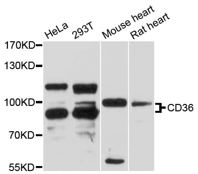 PathPlus™ Polyclonal Rabbit anti-Human CD36 Antibody (IHC, WB)