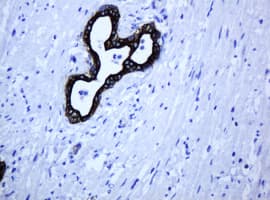 Monoclonal Mouse anti-Human ABCB1 / MDR1 / P Glycoprotein Antibody (clone OTI5B3, IHC)