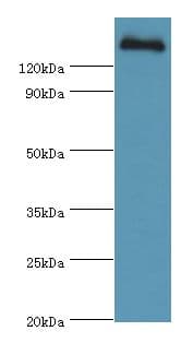 CFH / Complement Factor H Antibody (aa20-270)